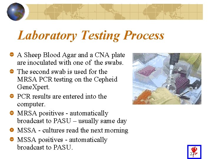 Laboratory Testing Process A Sheep Blood Agar and a CNA plate are inoculated with