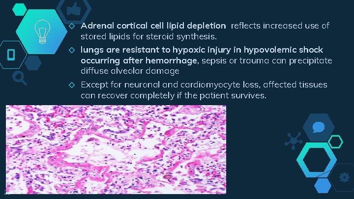 ◇ ◇ ◇ 29 Adrenal cortical cell lipid depletion reflects increased use of stored