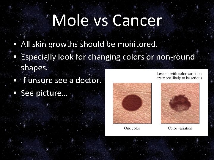 Mole vs Cancer • All skin growths should be monitored. • Especially look for