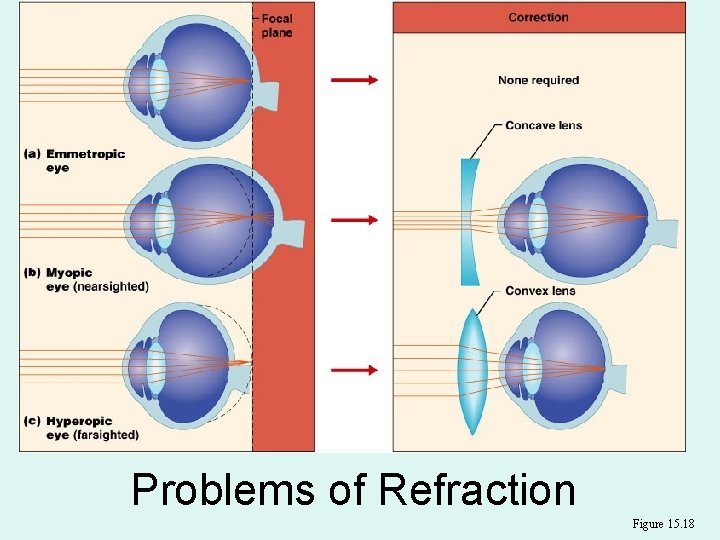 Problems of Refraction Figure 15. 18 Problems of Refraction Figure 15. 18
