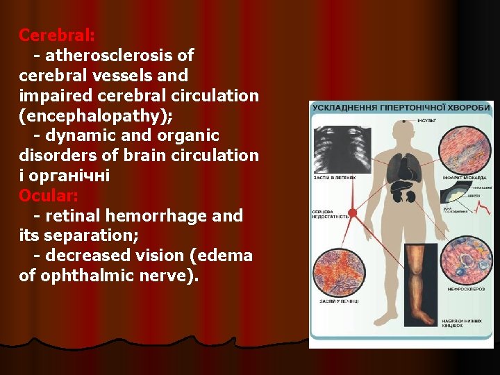 Symptoms and syndromes in arterial hypertension l Arterial