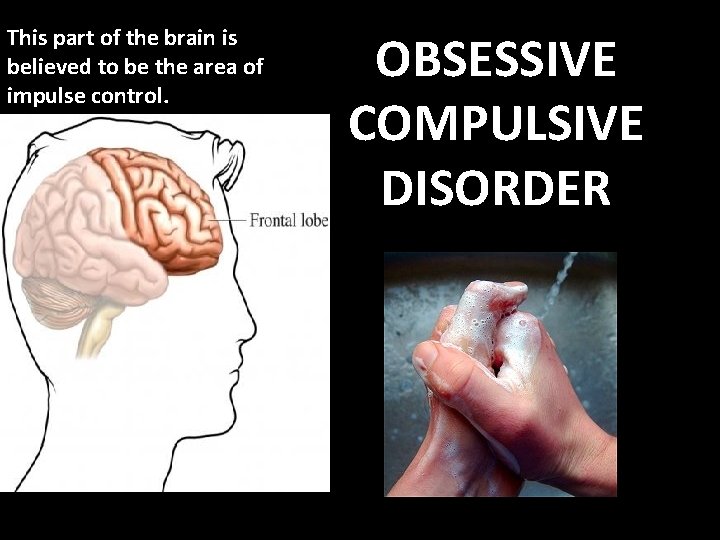 This part of the brain is believed to be the area of impulse control.