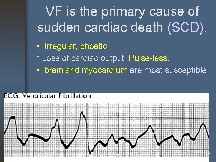 VF is the primary cause of sudden cardiac death (SCD). • Irregular, choatic. *