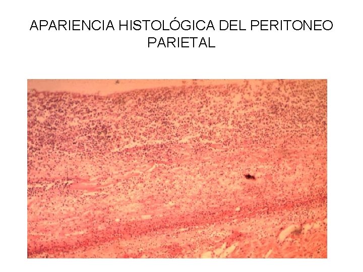 APARIENCIA HISTOLÓGICA DEL PERITONEO PARIETAL 