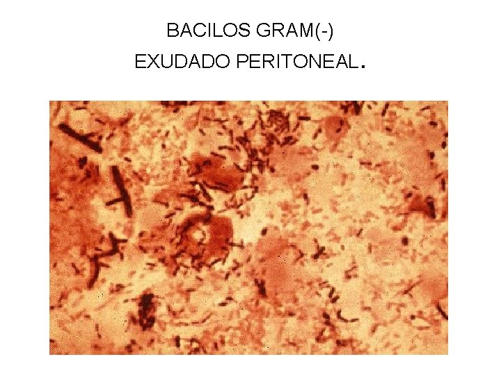 BACILOS GRAM(-) EXUDADO PERITONEAL. 