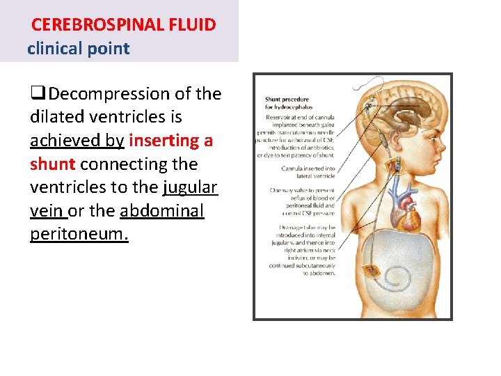 CEREBROSPINAL FLUID clinical point q. Decompression of the dilated ventricles is achieved by inserting
