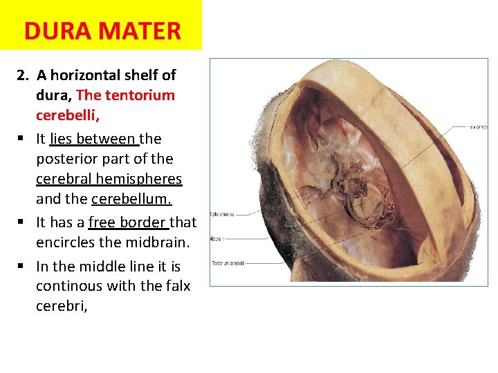 DURA MATER 2. A horizontal shelf of dura, The tentorium cerebelli, § It lies