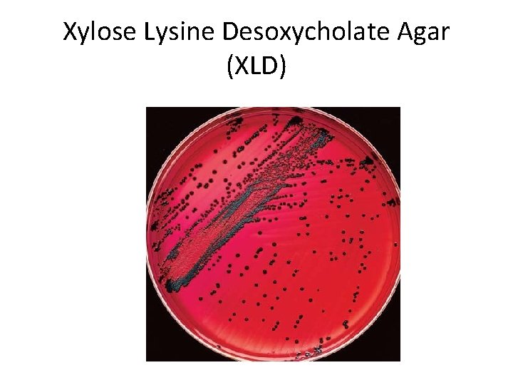 Xylose Lysine Desoxycholate Agar (XLD) 