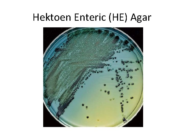 Hektoen Enteric (HE) Agar 