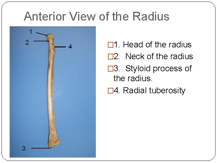 Anterior View of the Radius � 1. Head of the radius � 2. Neck