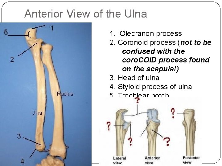 Anterior View of the Ulna 1. Olecranon process 2. Coronoid process (not to be