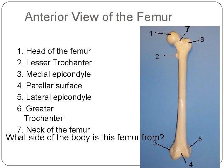 Anterior View of the Femur 7 1. Head of the femur 2. Lesser Trochanter