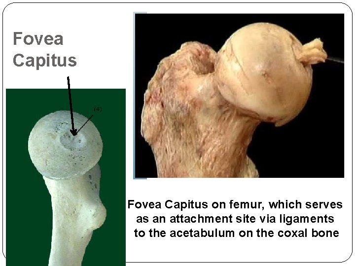 Fovea Capitus on femur, which serves as an attachment site via ligaments to the