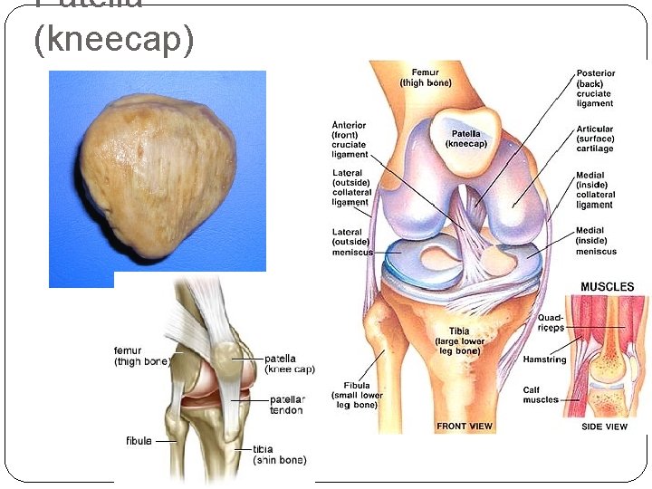Patella (kneecap) 