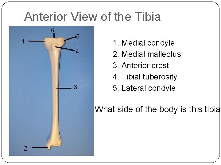 Anterior View of the Tibia 1. Medial condyle 2. Medial malleolus 3. Anterior crest