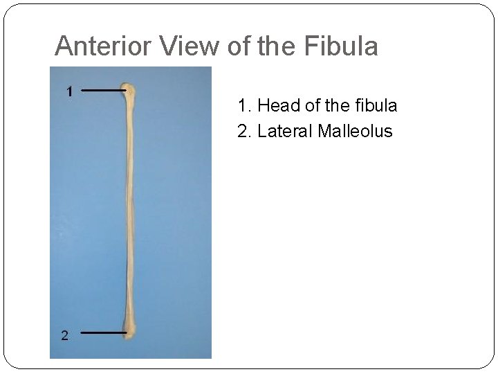 Anterior View of the Fibula 1. Head of the fibula 2. Lateral Malleolus 