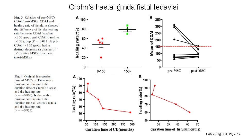 Crohn’s hastalığında fistül tedavisi Cao Y, Dig D S Sci, 2017 