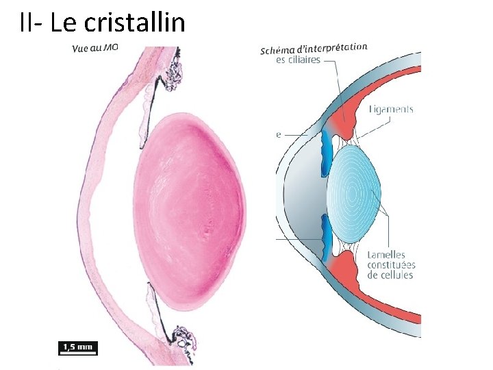 II- Le cristallin 