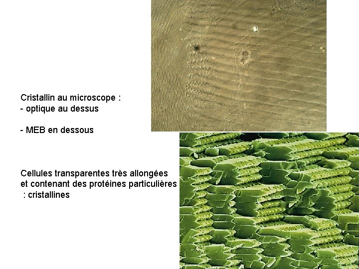 Cristallin au microscope : - optique au dessus - MEB en dessous Cellules transparentes