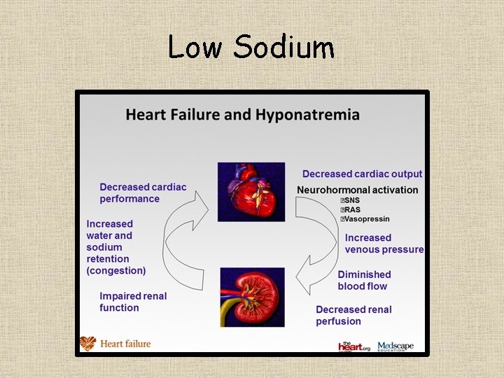 Low Sodium 