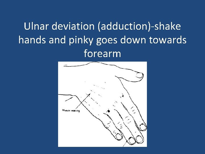Ulnar deviation (adduction)-shake hands and pinky goes down towards forearm 