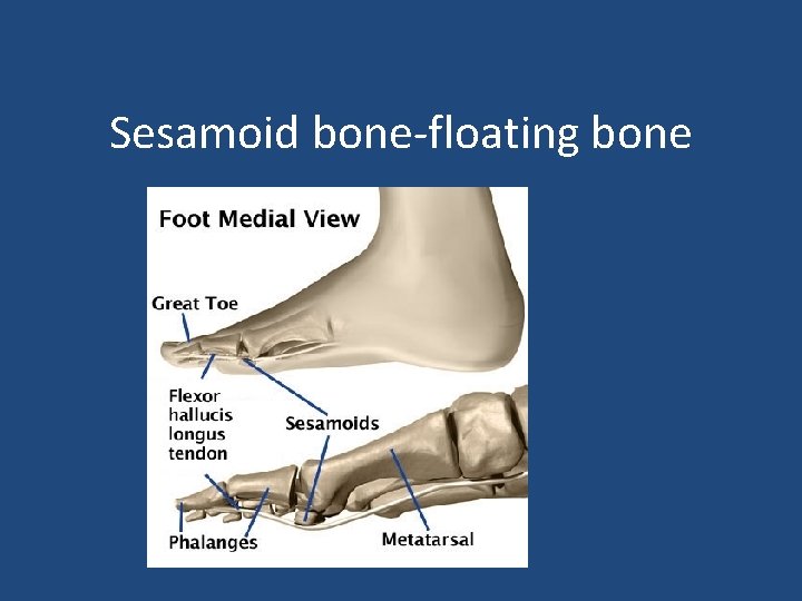 Sesamoid bone-floating bone 