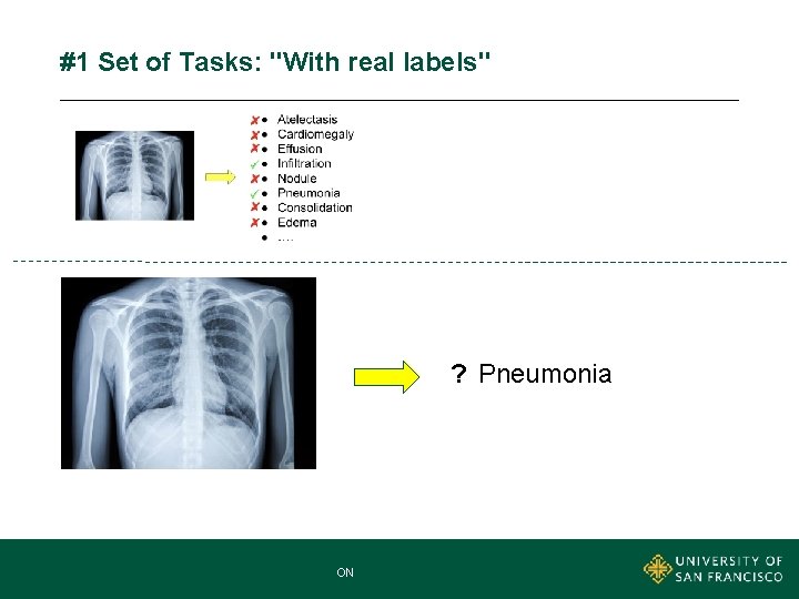 #1 Set of Tasks: "With real labels" ? Pneumonia MNA MASTER OF NONPROFIT ADMINISTRATION