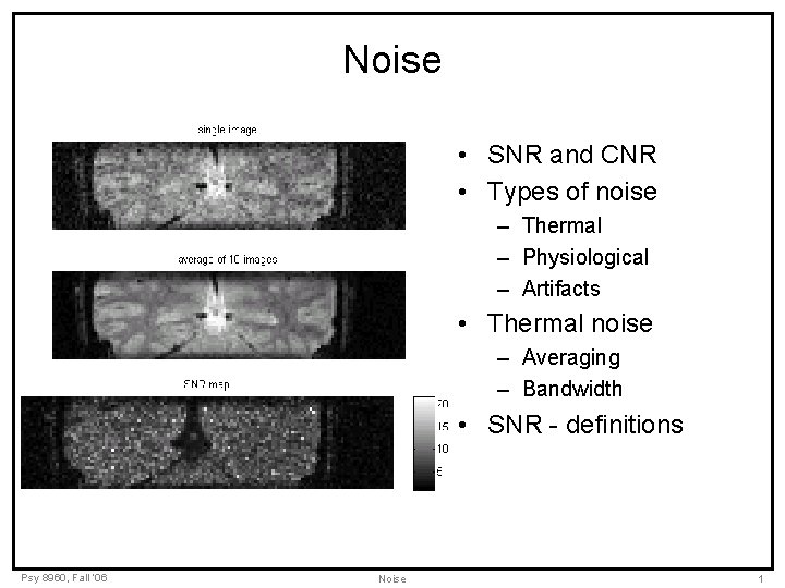 Noise • SNR and CNR • Types of noise – Thermal – Physiological –