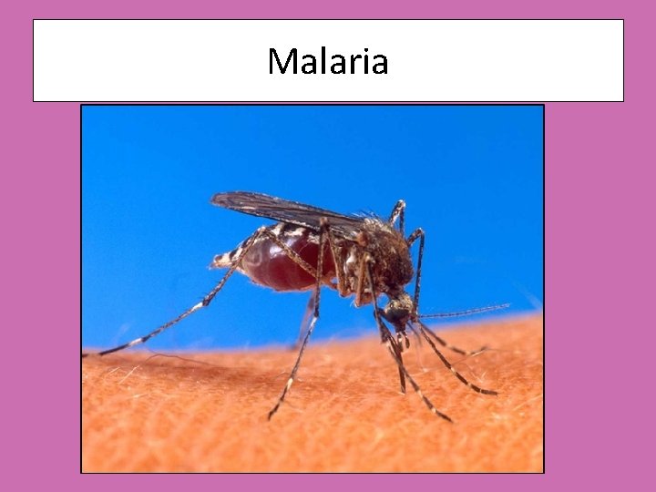 Malaria 