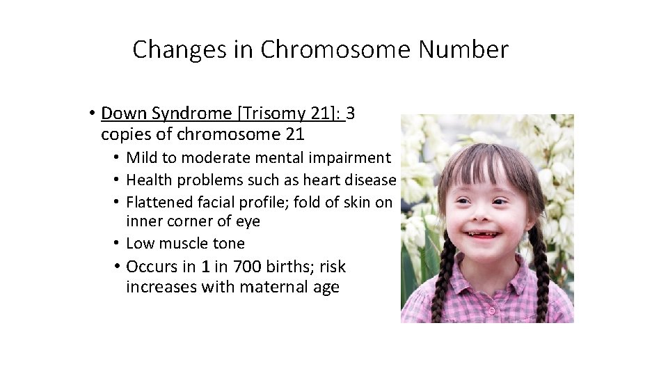 Changes in Chromosome Number • Down Syndrome [Trisomy 21]: 3 copies of chromosome 21