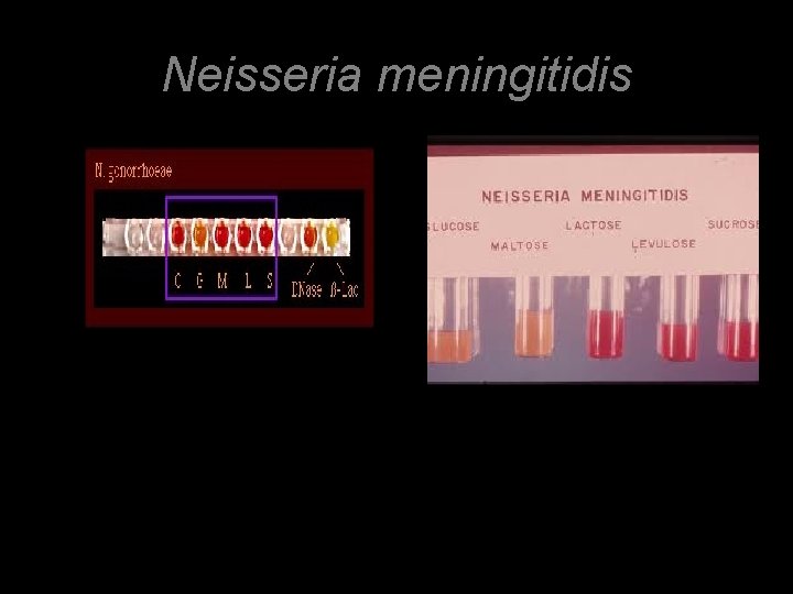 Neisseria meningitidis 