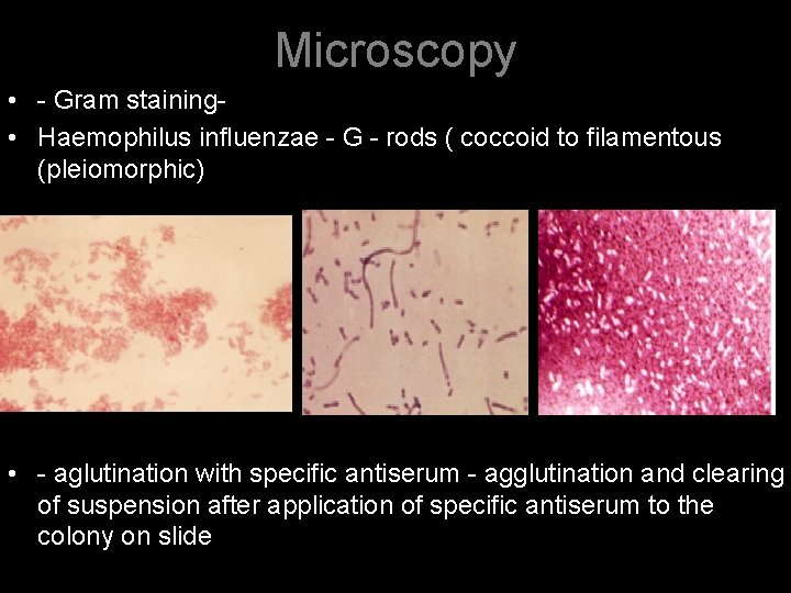 Microscopy • - Gram staining • Haemophilus influenzae - G - rods ( coccoid