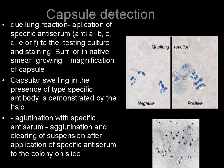 Capsule detection • quellung reaction- aplication of specific antiserum (anti a, b, c, d,