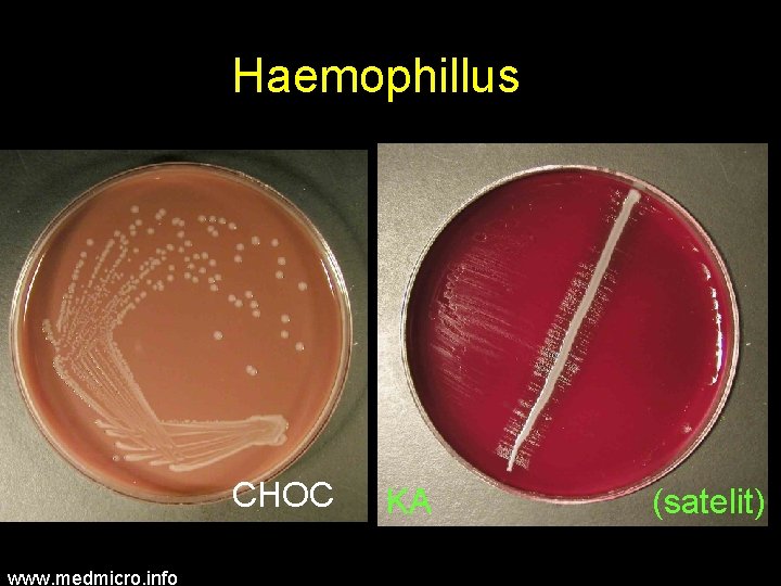 Haemophillus CHOC www. medmicro. info KA (satelit) 