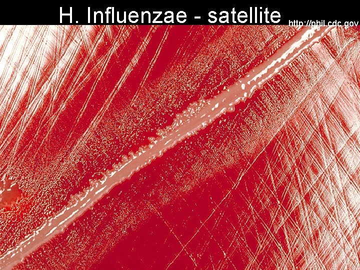 H. Influenzae - satellite http: //phil. cdc. gov 