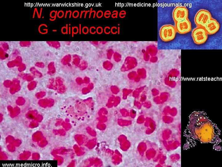 http: //www. warwickshire. gov. uk http: //medicine. plosjournals. org N. gonorrhoeae G - diplococci