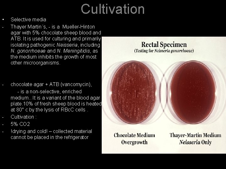 Cultivation • - Selective media Thayer Martin´s, - is a Mueller-Hinton agar with 5%