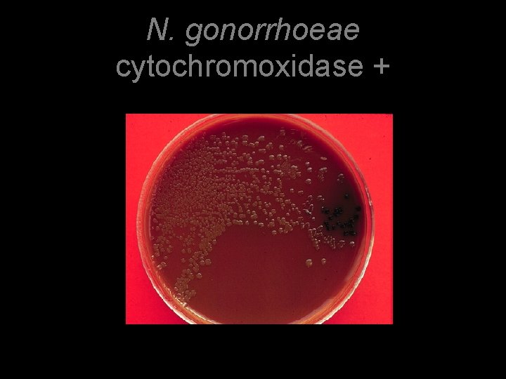 N. gonorrhoeae cytochromoxidase + 