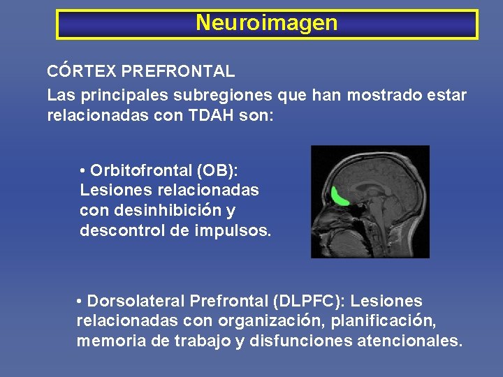 Neuroimagen CÓRTEX PREFRONTAL Las principales subregiones que han mostrado estar relacionadas con TDAH son: