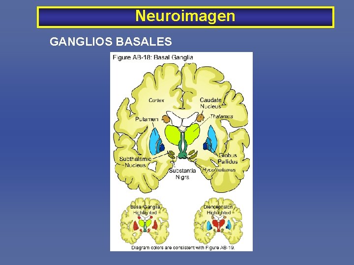 Neuroimagen GANGLIOS BASALES 