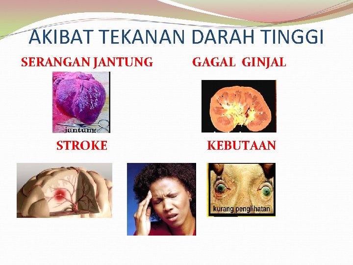 AKIBAT TEKANAN DARAH TINGGI SERANGAN JANTUNG STROKE GAGAL GINJAL KEBUTAAN 