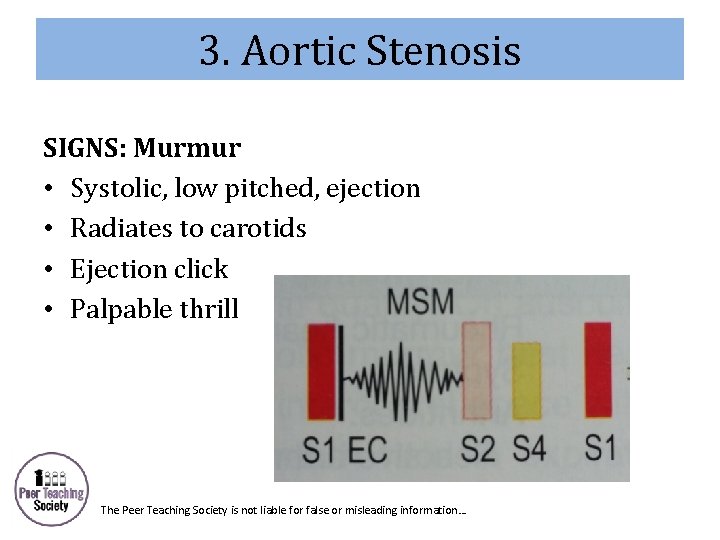 3. Aortic Stenosis SIGNS: Murmur • Systolic, low pitched, ejection • Radiates to carotids
