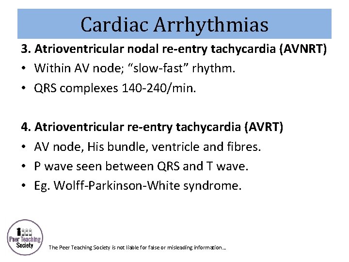 Cardiac Arrhythmias 3. Atrioventricular nodal re-entry tachycardia (AVNRT) • Within AV node; “slow-fast” rhythm.