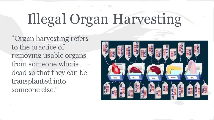 Illegal Organ Harvesting “Organ harvesting refers to the practice of removing usable organs from