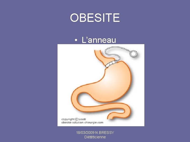 OBESITE • L’anneau 18/03/2009 N. BRESSY Diététicienne 