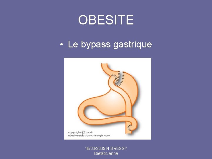 OBESITE • Le bypass gastrique 18/03/2009 N. BRESSY Diététicienne 