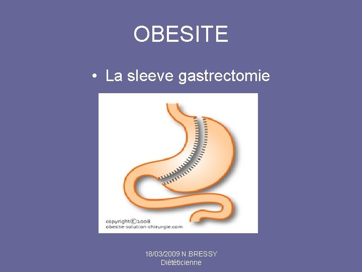 OBESITE • La sleeve gastrectomie 18/03/2009 N. BRESSY Diététicienne 
