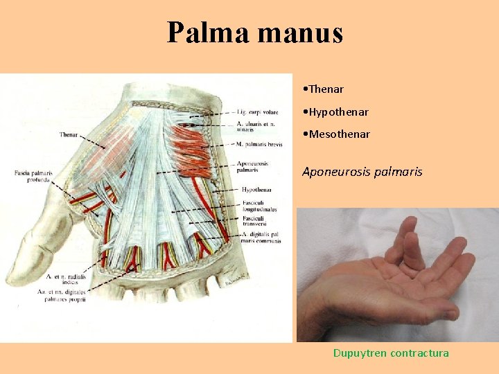 Palma manus • Thenar • Hypothenar • Mesothenar Aponeurosis palmaris Dupuytren contractura 