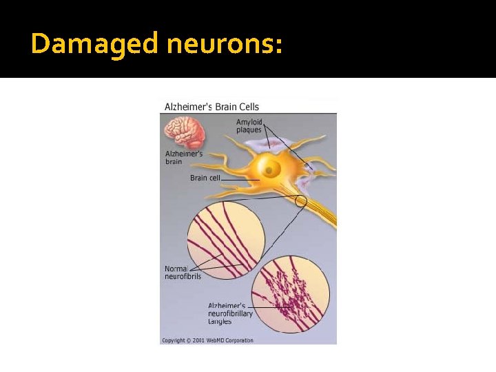 Damaged neurons: 