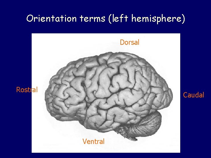 Orientation terms (left hemisphere) Dorsal Rostral Caudal Ventral 